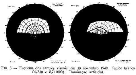 L'aracnoidite adesiva cronica è una condizione estremamente rara. Hemianopsia altitudinal inferior por aracnoidite ...