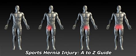 Néanmoins, avant de la détailler, nous devons connaître certains aspects de cet organe. Sports Hernia Injury: Top Doctor Explains ALL (Treatment ...