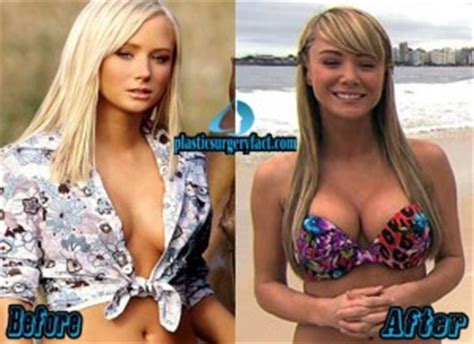 Sara jean underwood (born march 26, 1984) is an american model, television host, and actress who was chosen as the playmate of the month for the july 2006 issue of playboy magazine and later became playmate of the year in 2007. Sara Jean Underwood Plastic Surgery Before and After ...