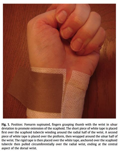 Different tissue injuries causing wrist pain or wrist joint pain. Two Ways to Tape the Wrist: Rigid Tape and Kinesiology ...
