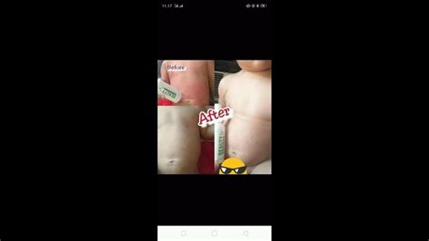 Scopri ricette, idee per la casa, consigli di stile e altre idee da provare. Obat Biang Keringat Untuk Bayi Dan Anak-anak | NATURA ...