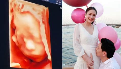 ภาพเซตนี้ของ นาตาลี เจียรวนนท์ และ ฟลุค เกริกพล จะหวานอบอุ่นแค่ไหน ว่าที่คุณแม่มาดูเป็นไอเดียกันค่ะ "ลี นาตาลี" อวดภาพอัลตราซาวด์ลูกสาวล่าสุด ชาวเน็ตบอกเหมือน ...