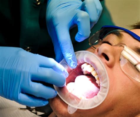 You might find it helpful to get the aftercare directions from your dentist before your mind is made fuzzy by the. Why to Have Wisdom Teeth Removal in Australia? - Natural ...