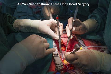 But it does seem pretty likely that any time you cut someone's chest open and start tinkering with the most vital organ in the body, it can be a bit perilous. All You Need to Know About Open Heart Surgery
