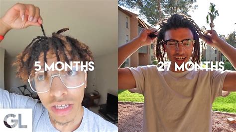 This liquid must then be massaged on to the scalp and allowed to dry out for a few minutes. 2 Years Of Hair Growth | Time Lapse - YouTube