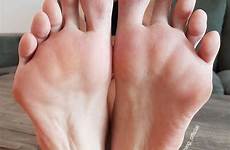 feet soles