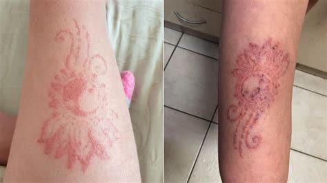 Henna temple provides a mobile service to the north queensland region. Sydney girl left nursing painful infection after receiving ...