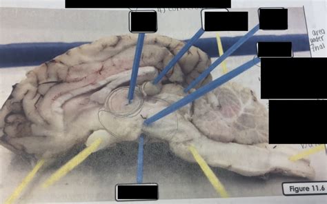 On this photo the iliac arteries are visible as they learn cat arteries veins with free interactive flashcards. Brain Anatomy Quizlet - Anatomy Drawing Diagram