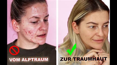 Verantwortlich hierfür sind die talgdrüsen bzw. Rauchen haut vorher nachher. Die 4 besten Tipps um das ...