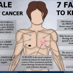 That's why it's extra important to know these signs and symptoms. Male Breast Cancer - 7 Facts to Know | Visual.ly