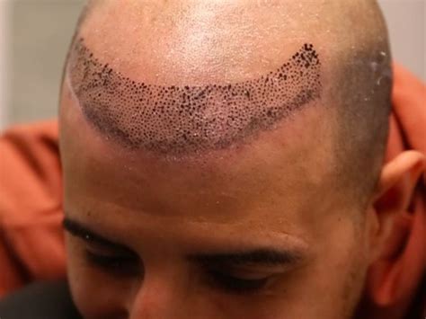 A Guide to Hairline Tattoos | Hairline tattoos, Hairline ...