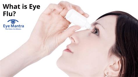 What is Eye Flu? | Eye Flu | Best Eye Treatment | EyeMantra