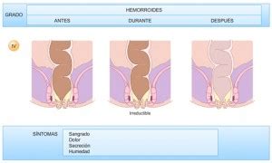 We did not find results for: Hemorroides · Centro Proctológico Dr. Germán Vázquez