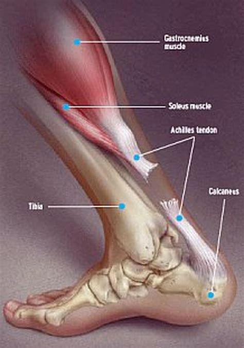 In both noninsertional and insertional achilles tendinitis, damaged tendon fibers may also calcify (harden). Terrell Suggs' Torn Achilles Tendon: How His Latest Injury ...