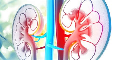What causes kidney cancer (renal cell cancer)? Anuria: Definition | Causes | Treatments