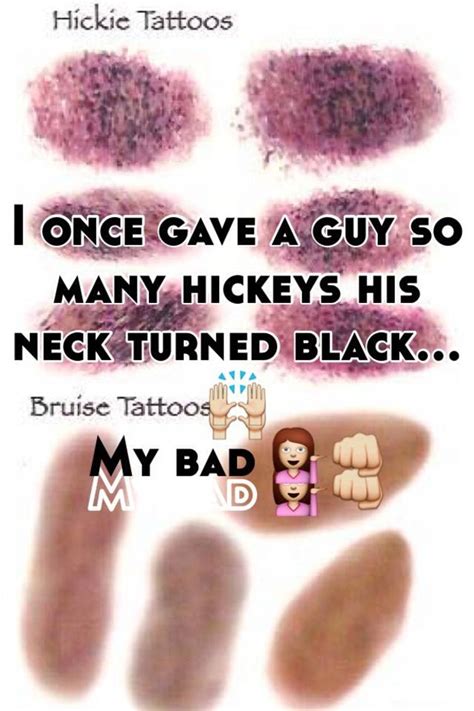How long does a hickey last for if left untreated? I once gave a guy so many hickeys his neck turned black ...