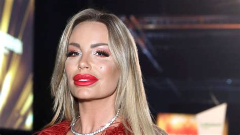 Die schnittwunde war so tief, dass sie genäht werden musste. „Kampf der Realitystars": Gina-Lisa Lohfink rastet aus und ...