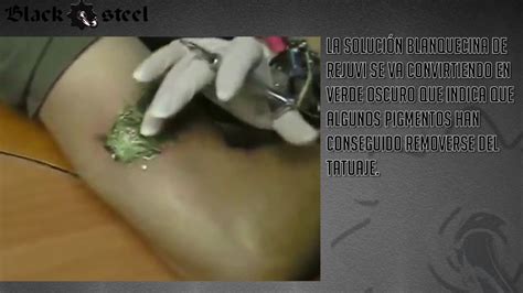 Once laser tattoo removal is done client has to wait minimum 8 weeks to get her skin healed totally and apply for a creamy tattoo remove technique. rejuvi tattoo remover - YouTube