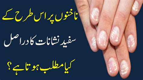136 best vitamin deficiency images vitamin deficiency vitamins health. What vitamin deficiency causes white spots on your nails ...