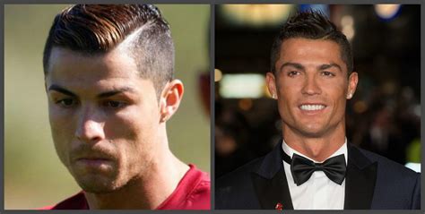 Welcome to the official facebook page of cristiano ronaldo. Cristiano Ronaldo - Zähne davor und danach, eine Auswahl ...