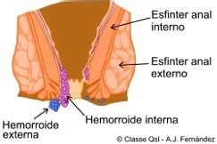 We did not find results for: Enciclopedia Salud: Definición de Hemorroides