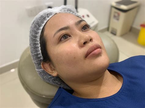 Dr laser indonesia ⭐ dilengkapi cara pakai & pengalaman pengguna ✓ alat terapi harga dr laser perfect 10 dengan 10 titik laser terapi. Kulit Kian Mulus! - Tampil Lebih Yakin Dengan Rawatan ...