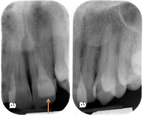 Radiographic interpretations in endodontic diagnosis liya alice thomas. Locate the Object: February 2015 - 11 ANSWER - Dr. G's ...