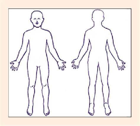This standard position (standing straight, looking forward, arms at your side, and facing forward) keeps everyone on the same page when you're talking anatomy and physiology. Anatomical diagram used to detail location of injury ...