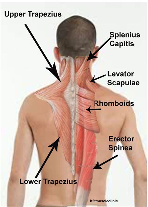 More specifically, this beautifully illustrated anatomy chart includes head and neck, thorax, multiple abdominal view, and frontal views. man-upper-back | Tight muscles, Muscle, Muscle spasms