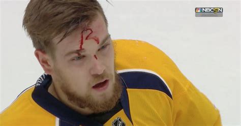 Most recently in the nhl with nashville predators. Social Media Had Some Fun With Viktor Arvidsson's 'R ...