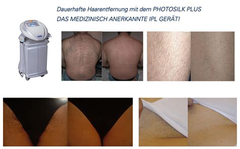 Von dauer ist nur die laser haarentfernung mittels der ipl technologie. Dauerhafte Haarentfernung mit IPL - Derma Medical Cosmetic