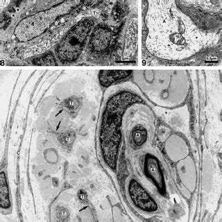 It starts in the merkel cells, which are usually in the top layer of the skin (the epidermis). (PDF) Sensory nerve endings in the hard palate and papilla ...