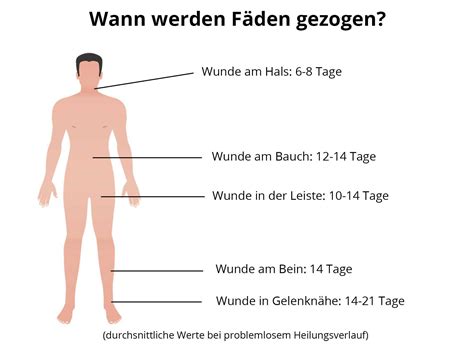 Die ziehung kann online verfolgt werden. Wann können Fäden von Wunden gezogen werden?