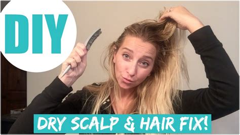 Dry hair, dry scalp—it's all a nuisance that can be treated if you just take the time. Easy & Affordable DIY Dry Scalp & Hair Fix - YouTube