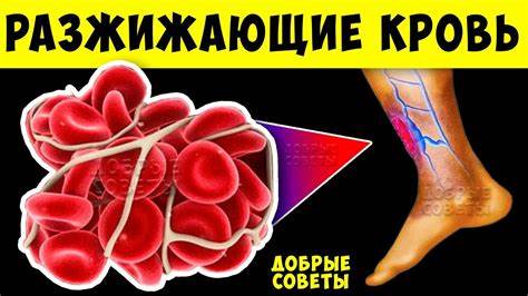 Диета при тромбозе сосудов Густая кровь, как Разжижать без таблеток? Профилактика Атеросклероза и Густая кровь, как Разжижать без таблеток? Профилактика Атеросклероза и Диета при тромбозе сосудов