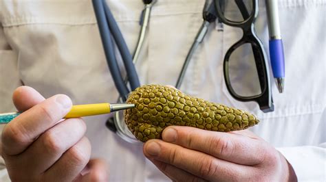Pancreatic cancer may cause certain signs and symptoms. Symptoms of Pancreatic Cancer | Northwestern Medicine