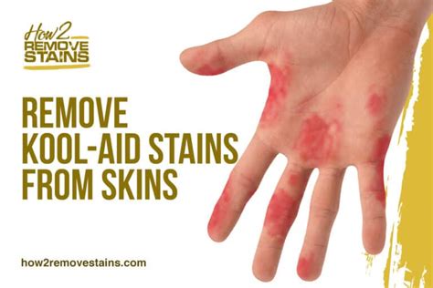 Check spelling or type a new query. How to remove Kool-Aid stains from skin  Detailed Answer 