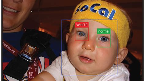 If you notice any of the following signs or symptoms, let your child's doctor know: An App That Can Catch Early Signs Of Eye Disease In A ...