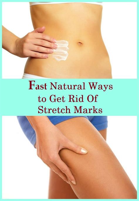 Filler dissolved with hyaluronidase festoons and malar mounds can wax and wane — that is their nature. Fast, Natural Ways to Get Rid Of Stretch Marks