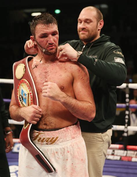 Davies, philip glenister, steve bunce. Hughie Fury: Acne almost ended boxing star's title dream ...