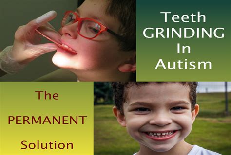 When to see the dentist? Teeth Grinding in Autism and How to Stop it : The ...