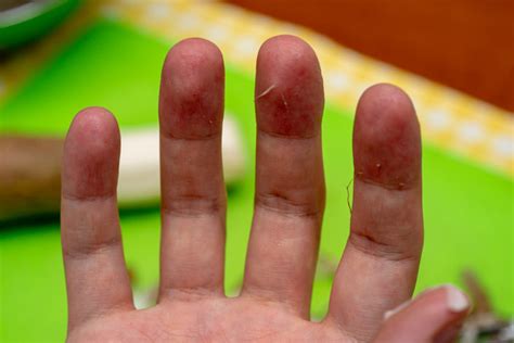 トップイメージカタログ: トップ 100+ 大和 芋 かゆい