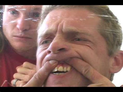 Will they need to pull his tooth? The Tooth Incident - YouTube