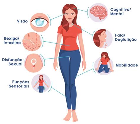Como vimos na seção definição da esclerose múltipla. Esclerose Múltipla: o que é, causas e sintomas - Sanofi no ...