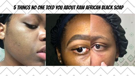 Three months ago i started looking for a body soap that would help treat back acne. 5 Things No One Told You About Raw African Black Soap ...