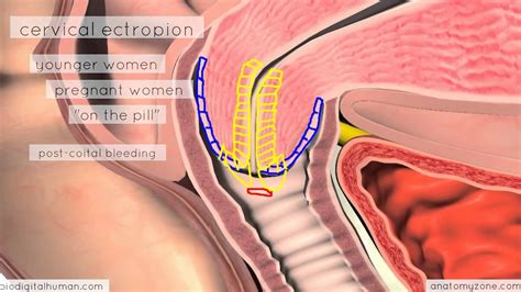 Create an interdimensional vr space or avatar prizes inc. Cervix 3D Anatomy Tutorial - YouTube