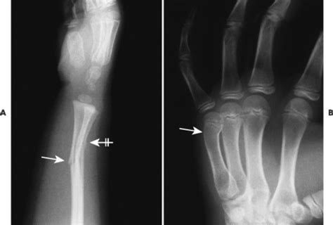 10. Trauma | Radiology Key