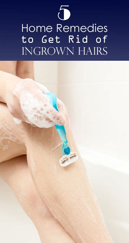 Do you know how to get rid of ingrown hair? 5 Home Remedies to Get Rid of Ingrown Hairs on Legs ...
