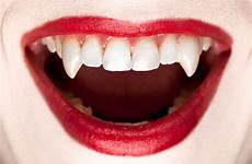 vampire teeth halloween vampires fangs stock disorder likely fake istock royalty globalnews did ca getty really arose medical true story