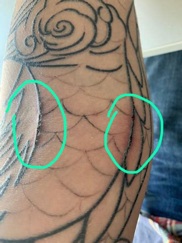 Sollte das passieren, kann man die stelle nachstechen. Tattoo-Verheilung, ist so ein Schorf normal? (Gesundheit ...